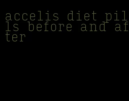 accelis diet pills before and after