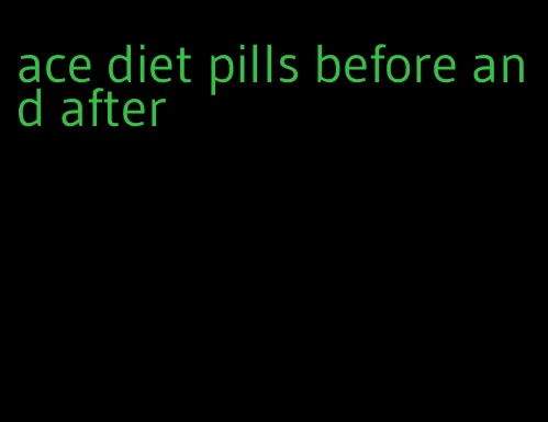 ace diet pills before and after