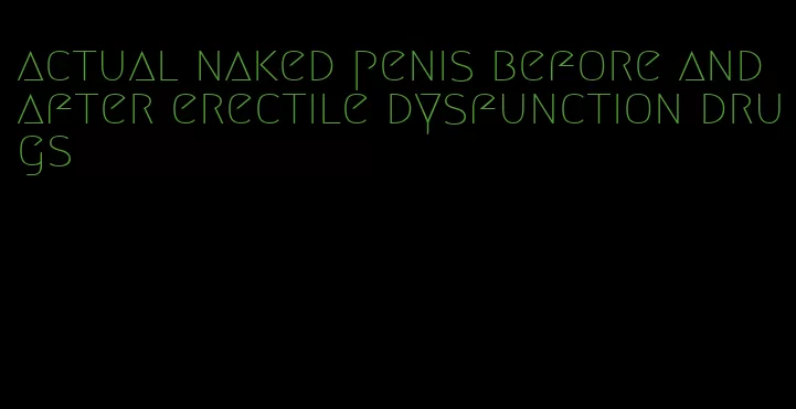 actual naked penis before and after erectile dysfunction drugs