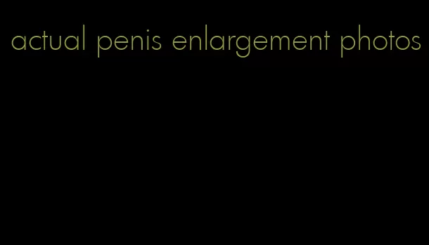 actual penis enlargement photos