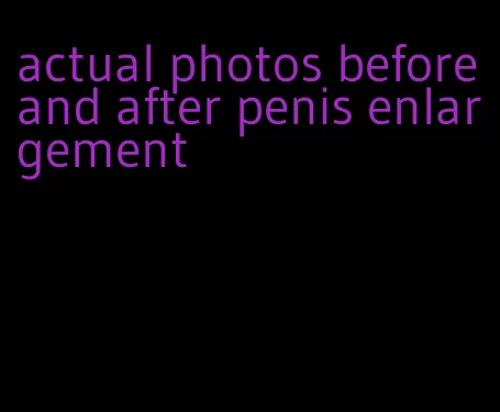 actual photos before and after penis enlargement