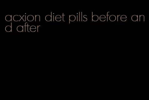 acxion diet pills before and after