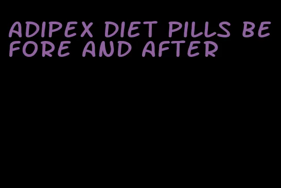 adipex diet pills before and after