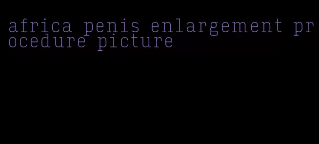 africa penis enlargement procedure picture