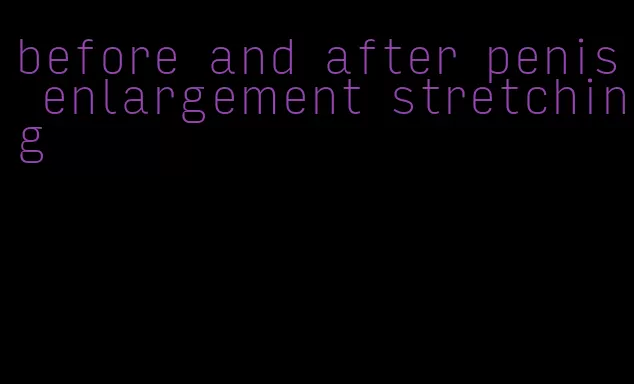 before and after penis enlargement stretching