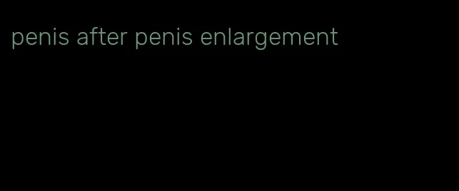 penis after penis enlargement