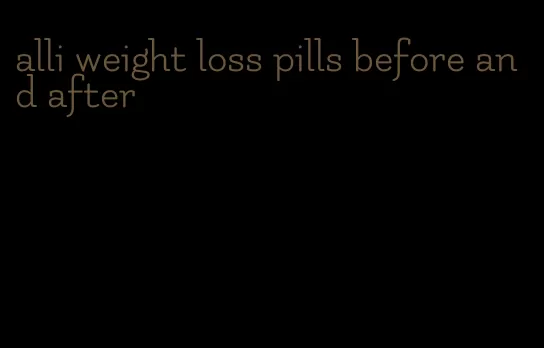 alli weight loss pills before and after