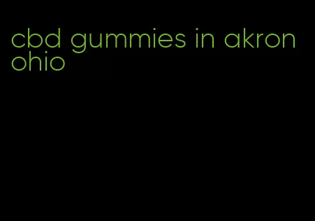 cbd gummies in akron ohio