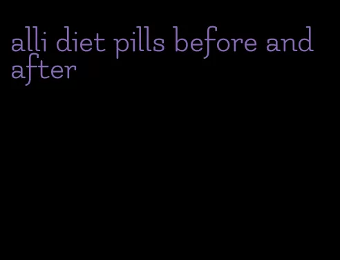 alli diet pills before and after