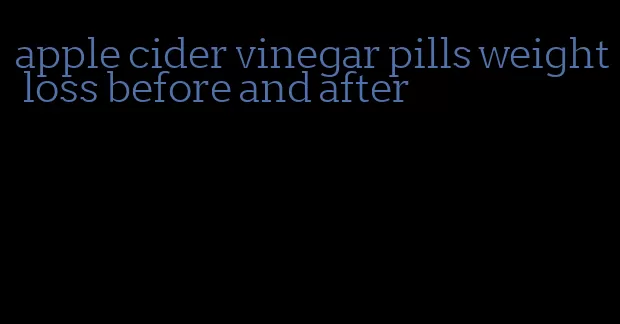 apple cider vinegar pills weight loss before and after