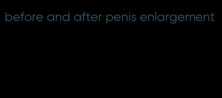 before and after penis enlargement