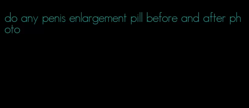 do any penis enlargement pill before and after photo