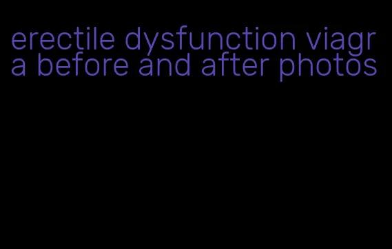 erectile dysfunction viagra before and after photos