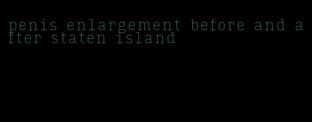 penis enlargement before and after staten island