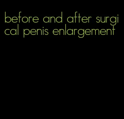 before and after surgical penis enlargement