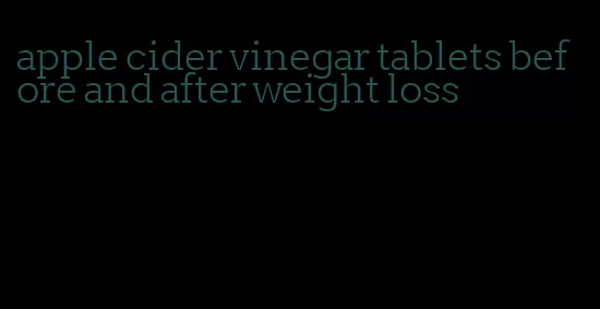 apple cider vinegar tablets before and after weight loss