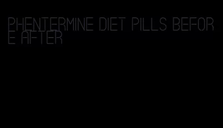 phentermine diet pills before after