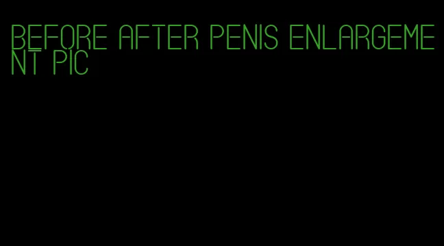 before after penis enlargement pic