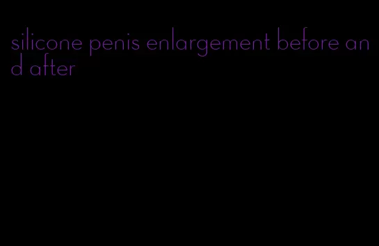 silicone penis enlargement before and after