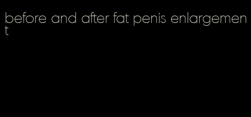 before and after fat penis enlargement