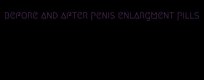 before and after penis enlargment pills