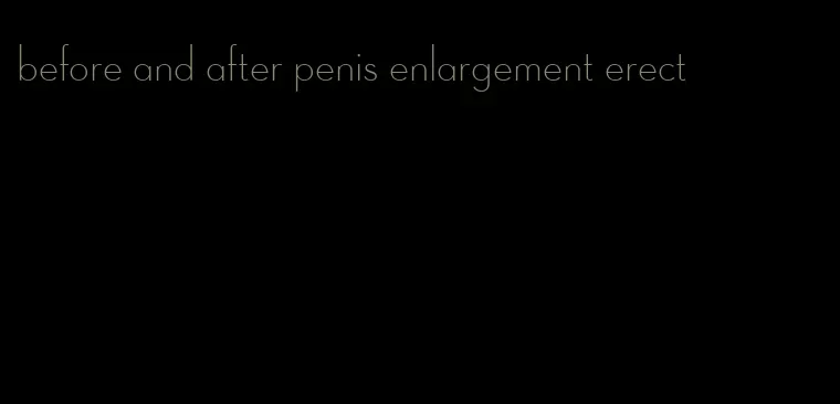 before and after penis enlargement erect