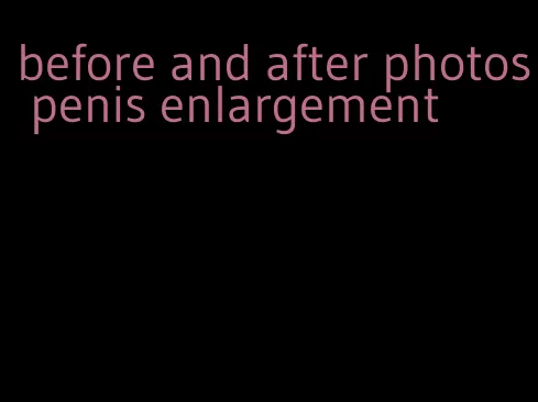 before and after photos penis enlargement