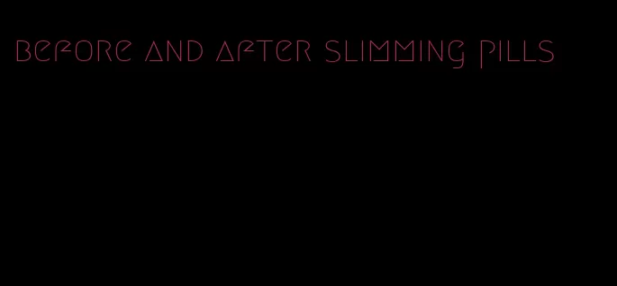 before and after slimming pills