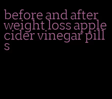 before and after weight loss apple cider vinegar pills