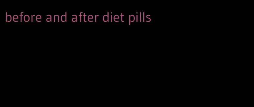 before and after diet pills