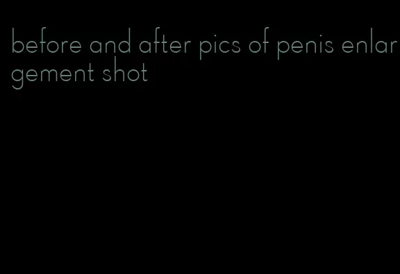 before and after pics of penis enlargement shot