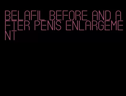 belafil before and after penis enlargement