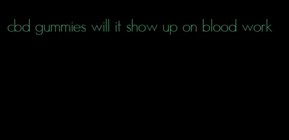 cbd gummies will it show up on blood work