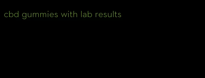 cbd gummies with lab results