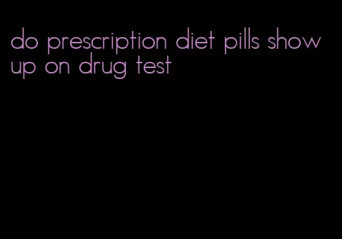 do prescription diet pills show up on drug test