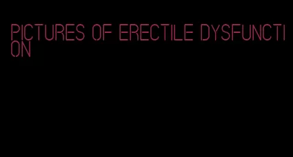 pictures of erectile dysfunction