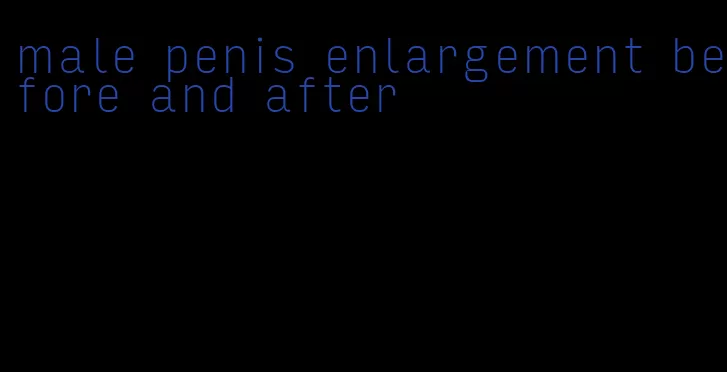 male penis enlargement before and after