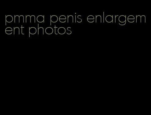 pmma penis enlargement photos