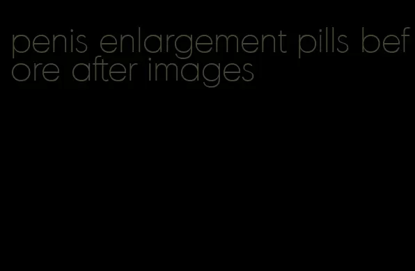 penis enlargement pills before after images