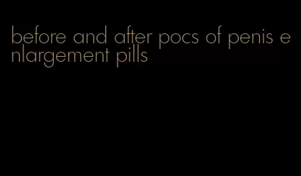 before and after pocs of penis enlargement pills