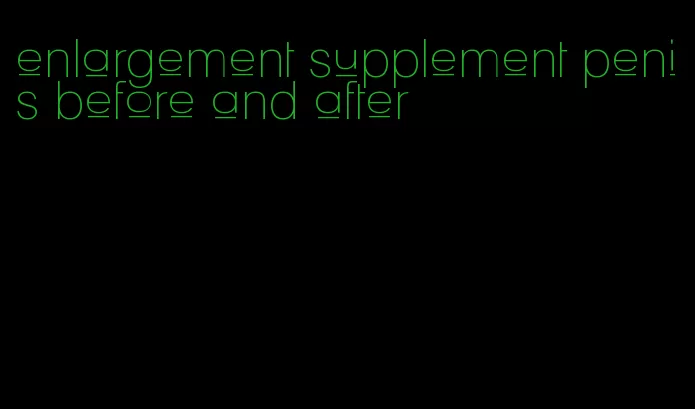 enlargement supplement penis before and after