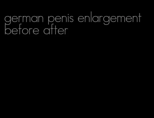 german penis enlargement before after