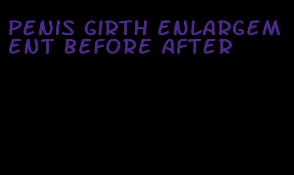 penis girth enlargement before after