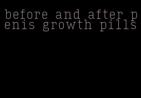 before and after penis growth pills