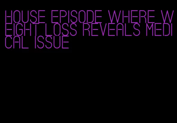 house episode where weight loss reveals medical issue