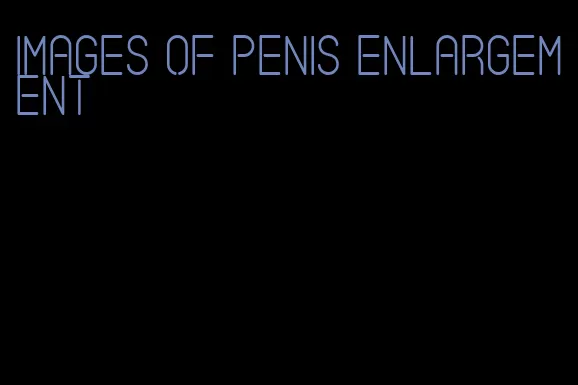 images of penis enlargement