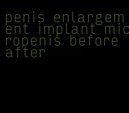 penis enlargement implant micropenis before after