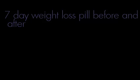 7 day weight loss pill before and after