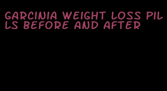 garcinia weight loss pills before and after