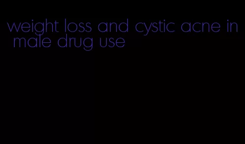 weight loss and cystic acne in male drug use